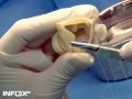 Запчасти для сердца можно сделать только вручную
