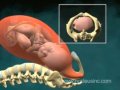 Роды в живую (3D)